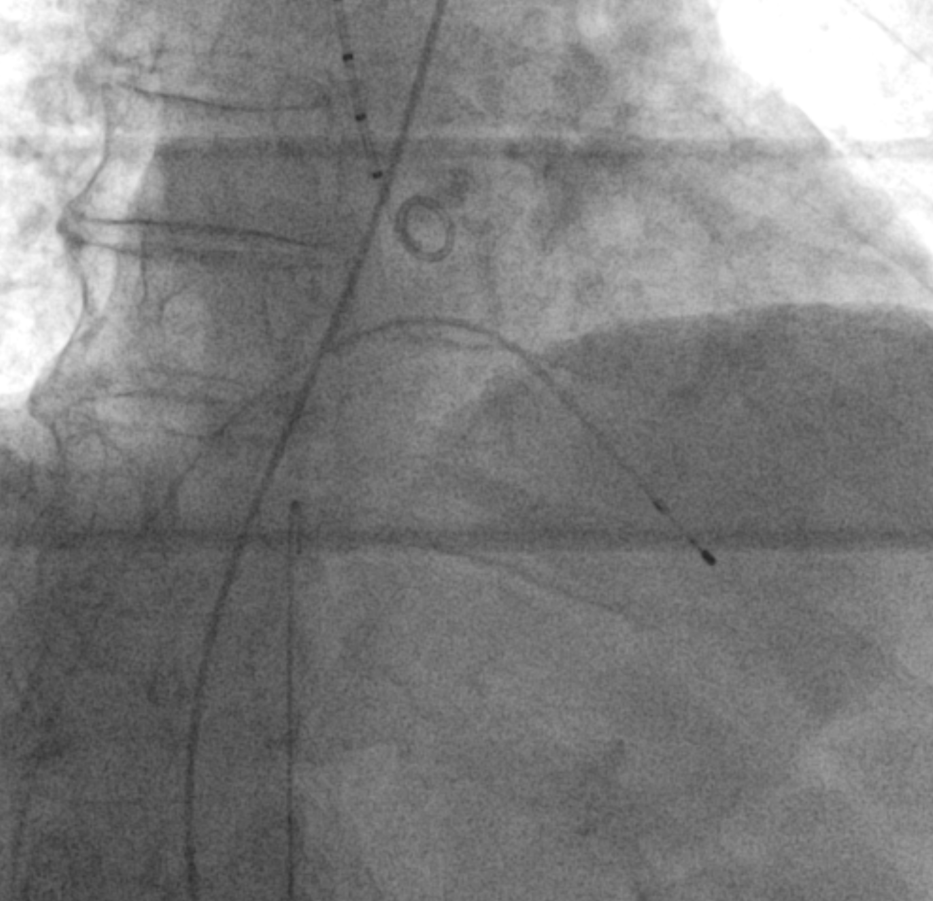x-ray